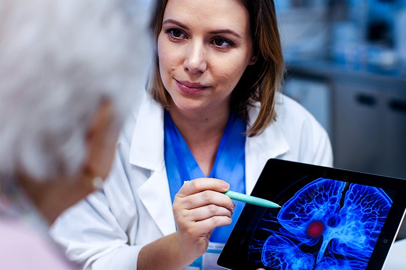 What to expect after a stroke